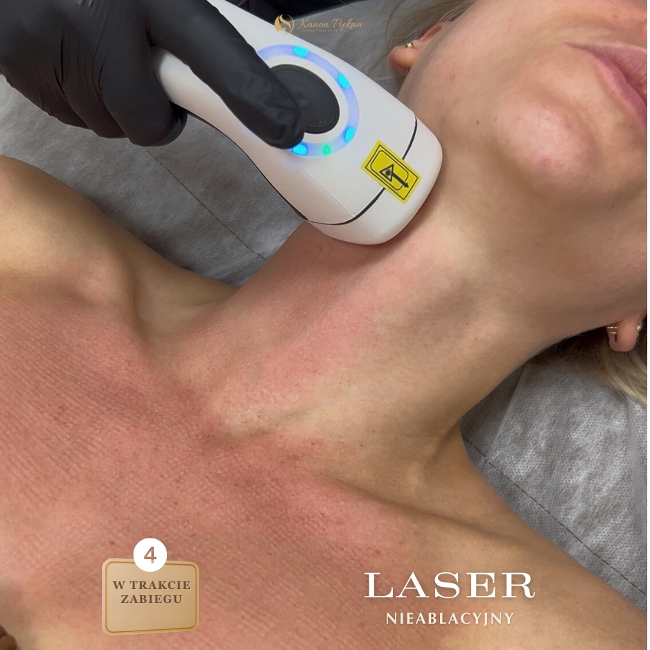 Po kilku tygodniach – lepsza gęstość i jędrność