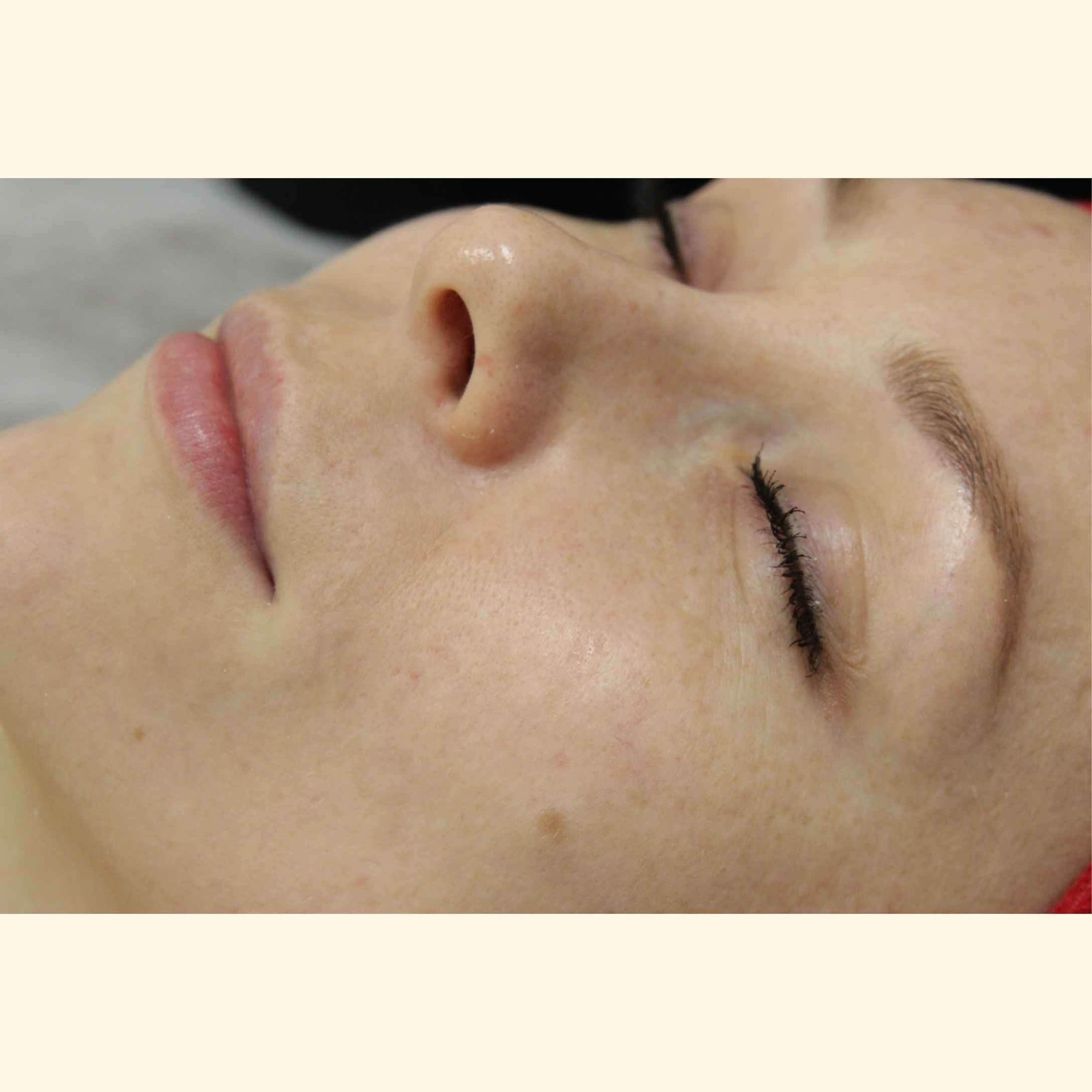 Po kilku tygodniach – lepsza gęstość i jędrność